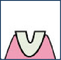 STEP.2