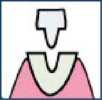 STEP.3