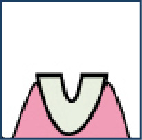 STEP.2