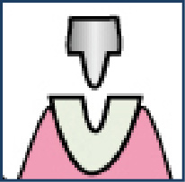 STEP.3
