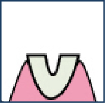 STEP.2