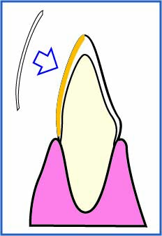 STEP.1