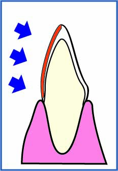 STEP.2