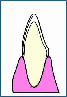 STEP.3