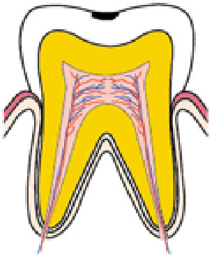 C1