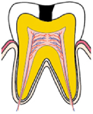C2