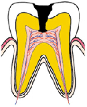 C3
