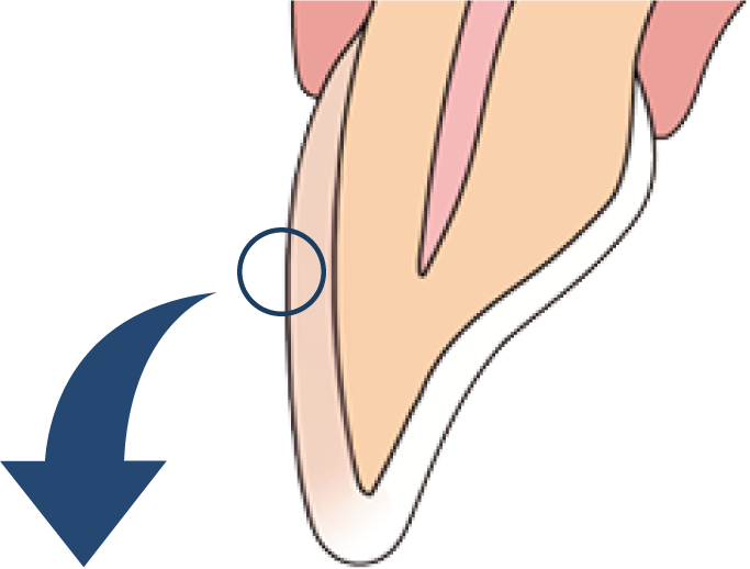 歯の断面のイラスト
